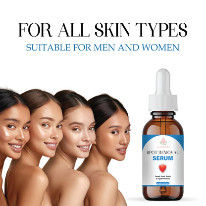Spot Removal Serum for Dark Spots, Pigmentation & Acne Scars | Skin Brightening & Even Tone Formula with Niacinamide & Vitamin C | Lightweight, Non-Sticky Face Serum for Men & Women