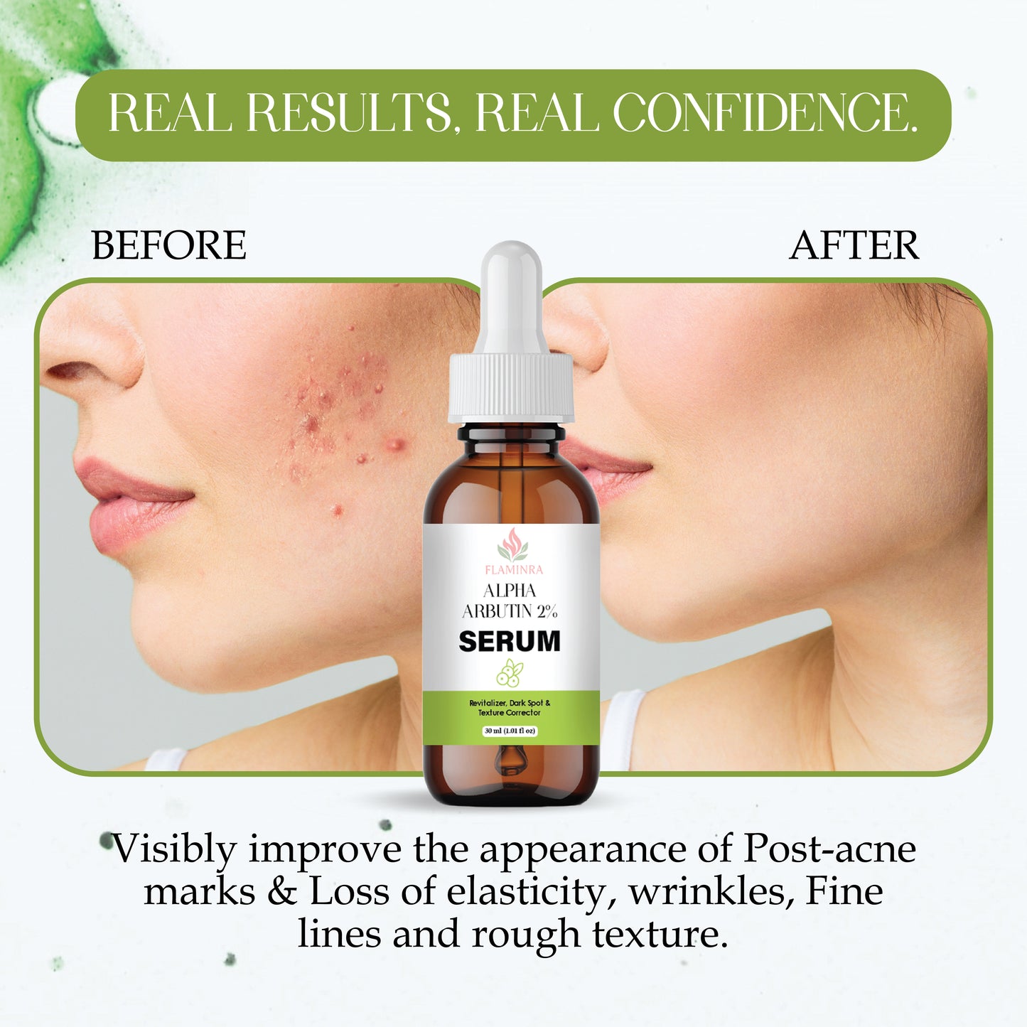 2% Alpha Arbutin Serum for Face | Dark Spot Remover | Skin Brightening & Pigmentation Control | Even Skin Tone | Lightweight, Non-Sticky Formula