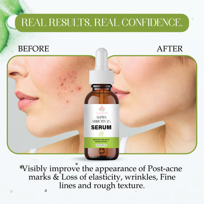 2% Alpha Arbutin Serum for Face | Dark Spot Remover | Skin Brightening & Pigmentation Control | Even Skin Tone | Lightweight, Non-Sticky Formula