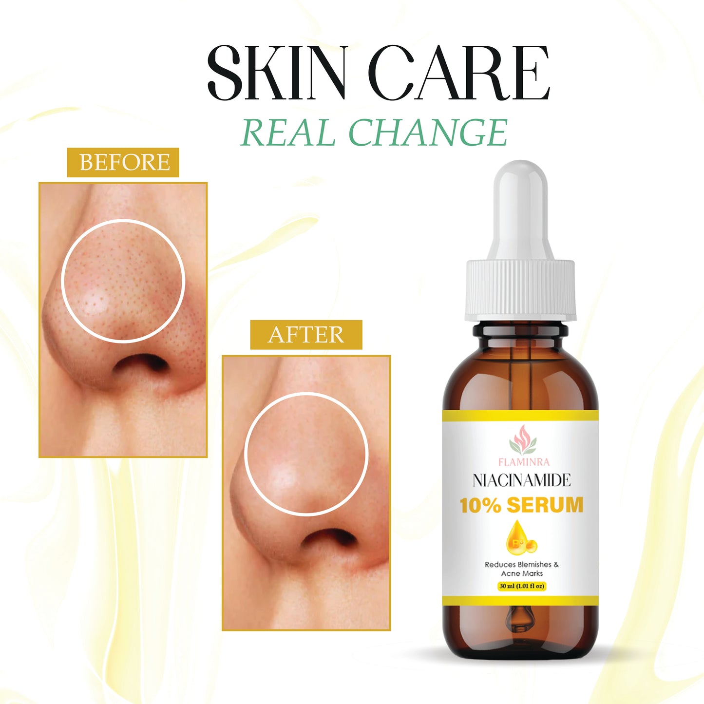 10% Niacinamide Face Serum for Acne Marks, Oil Control & Brightening | Reduces Dark Spots, Minimizes Pores & Strengthens Skin Barrier | Lightweight, Non-Greasy Formula
