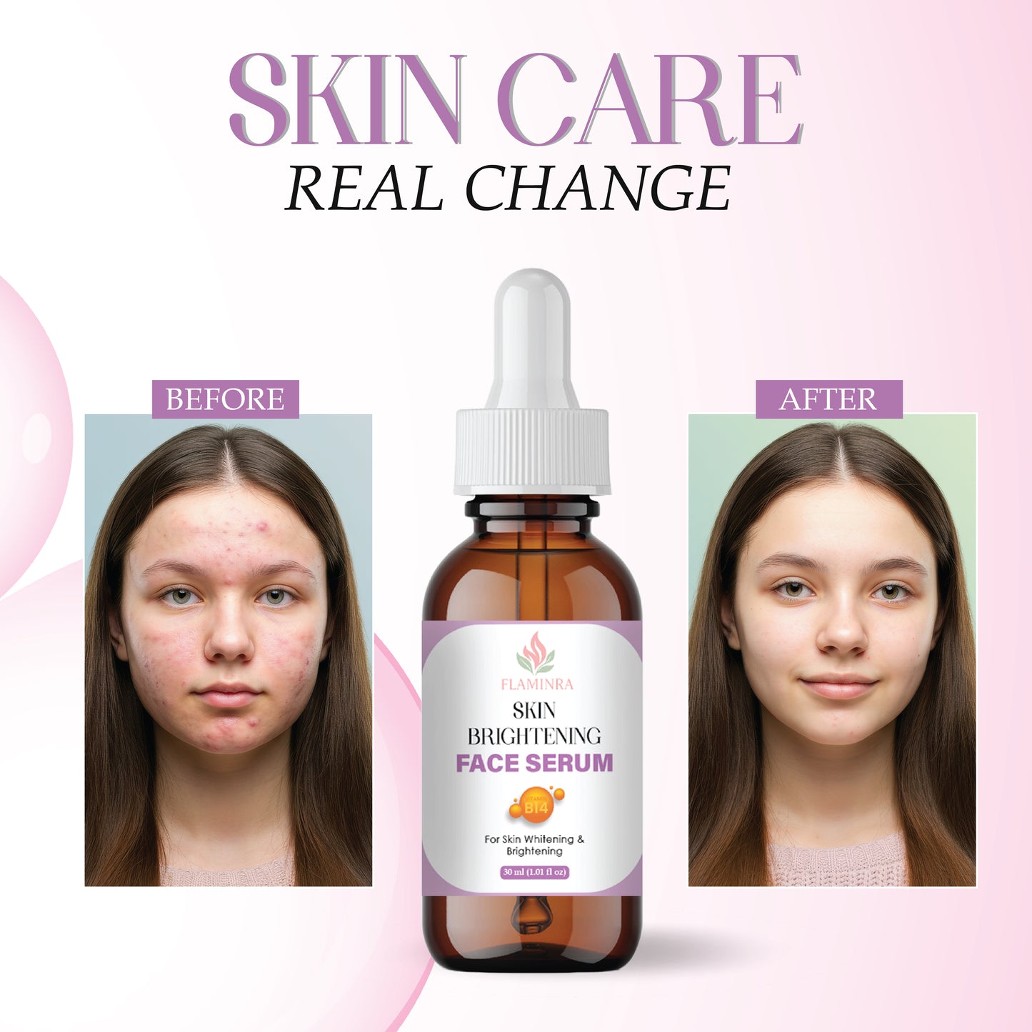 Skin Brightening Serum with Vitamin C, Niacinamide & Hyaluronic Acid | Reduces Dark Spots, Evens Skin Tone & Boosts Radiance | Lightweight & Non-Greasy