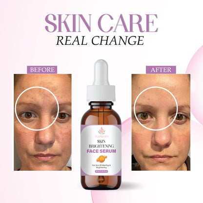 Skin Brightening Serum with Vitamin C, Niacinamide & Hyaluronic Acid | Reduces Dark Spots, Evens Skin Tone & Boosts Radiance | Lightweight & Non-Greasy