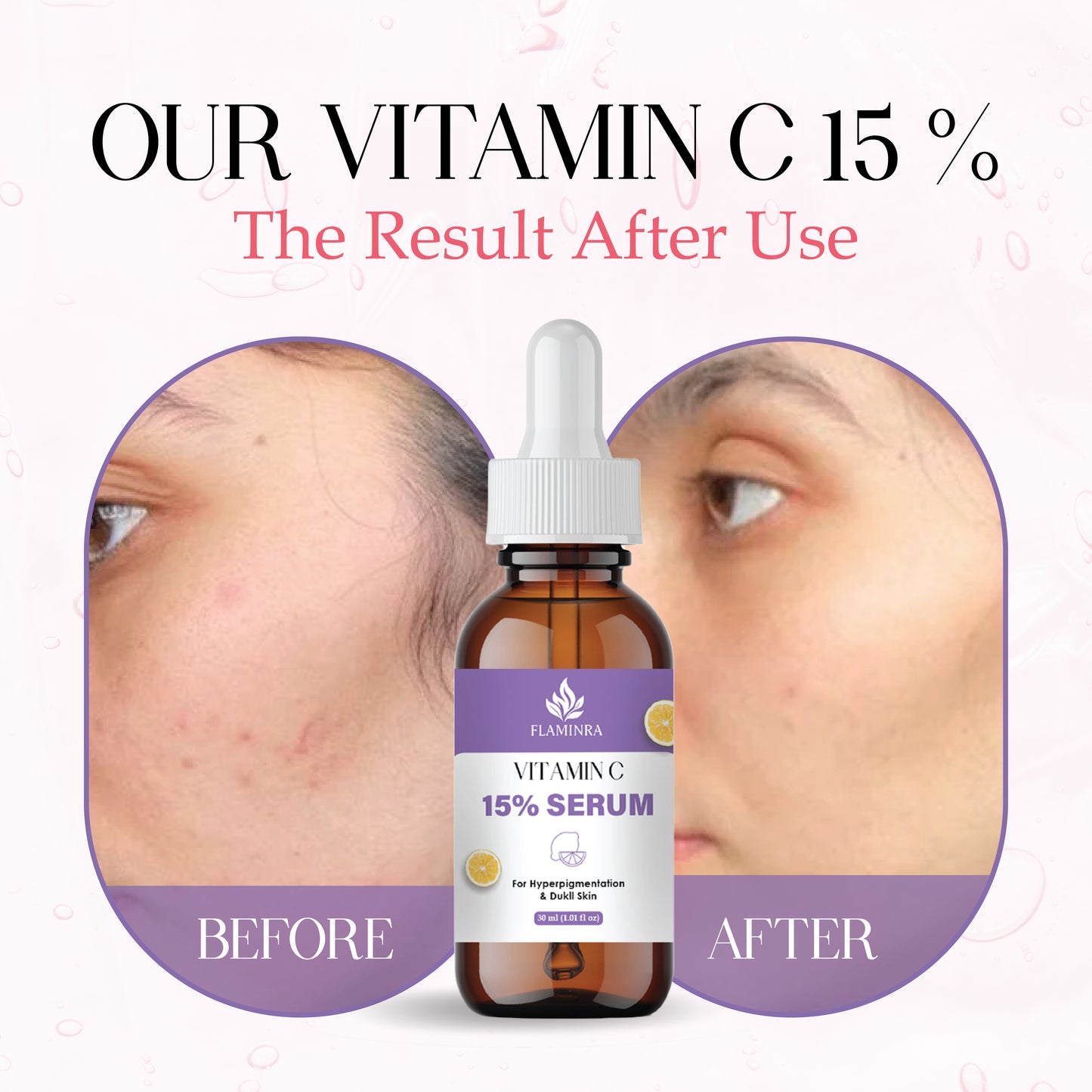 15% Vitamin C Face Serum with Hyaluronic Acid & Vitamin E | Brightening, Anti-Aging & Dark Spot Reduction | Skin Hydration & Even Tone Serum for Men & Women