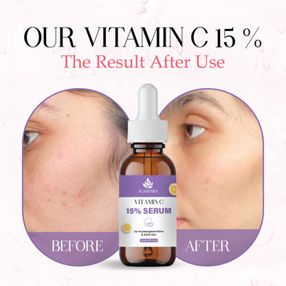 15% Vitamin C Face Serum with Hyaluronic Acid & Vitamin E | Brightening, Anti-Aging & Dark Spot Reduction | Skin Hydration & Even Tone Serum for Men & Women